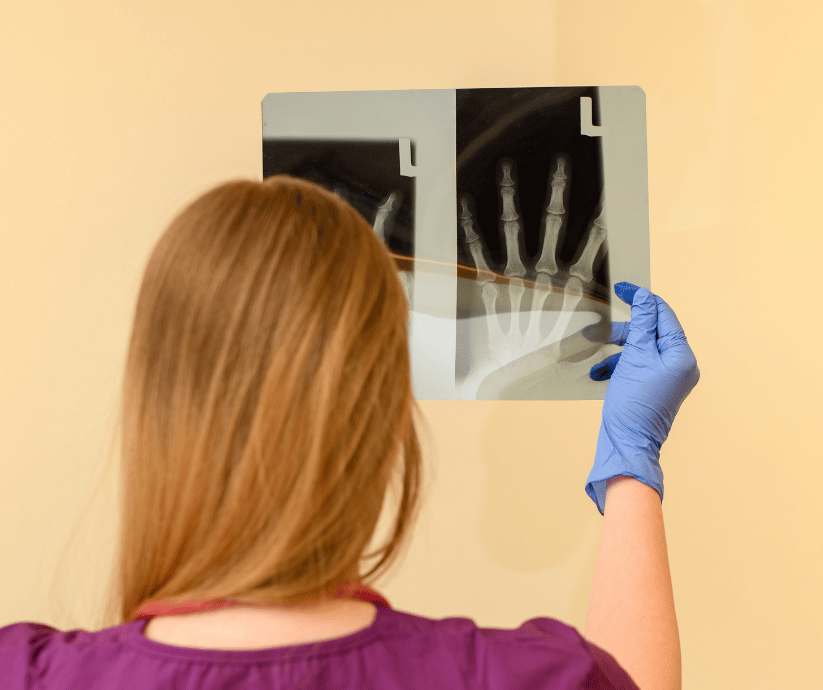 Factors overview image