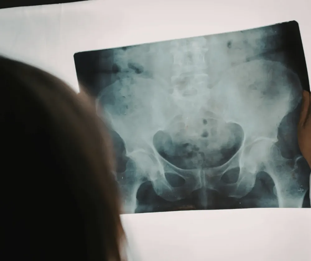 Pelvis