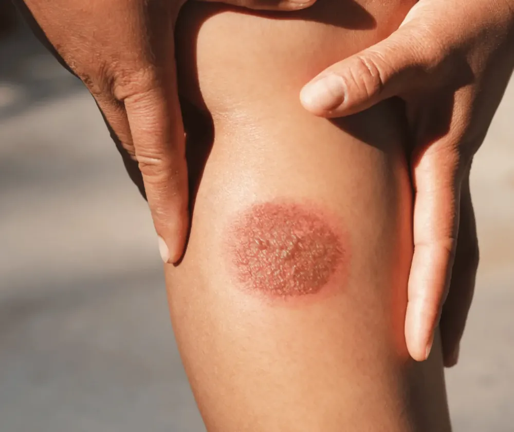 Road Rash image