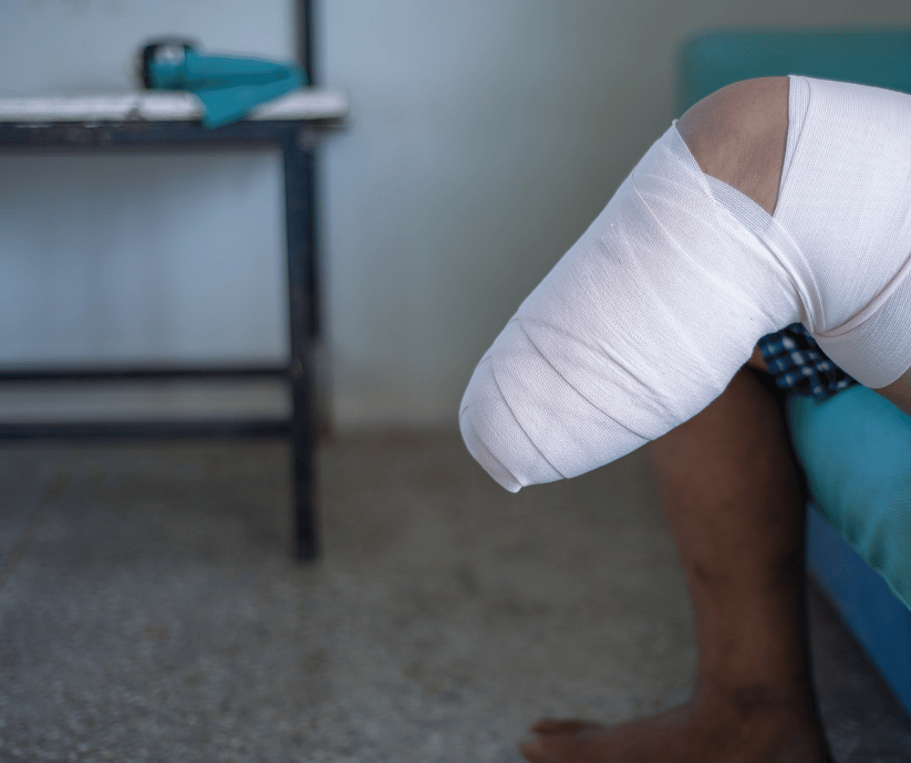 Permanent Disability